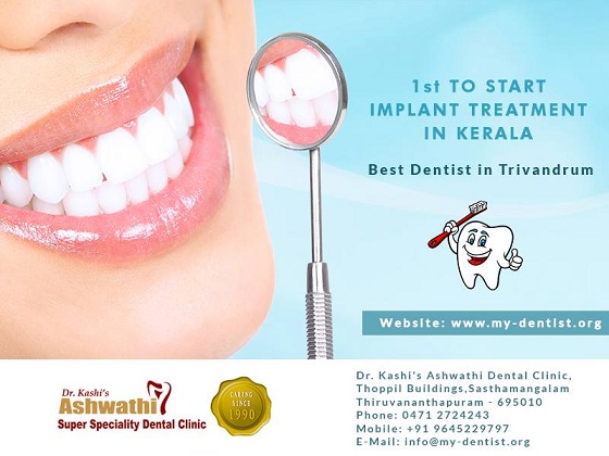 Dental Implant Treatment by Dr Kashi Ashwathi Dental Clinic